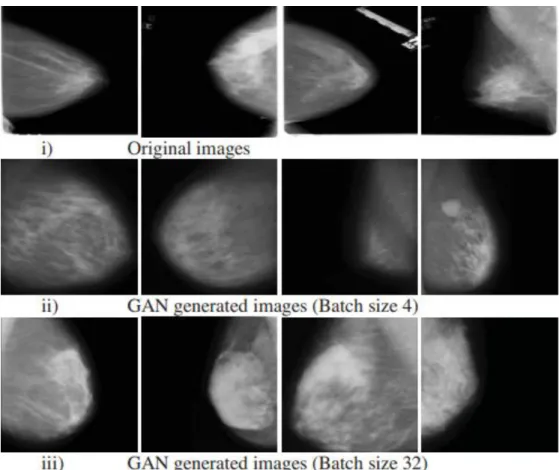 Figure 2-15: Original and GANs generated images with batch size 4 and 32 (Desai et  al., 2020) 