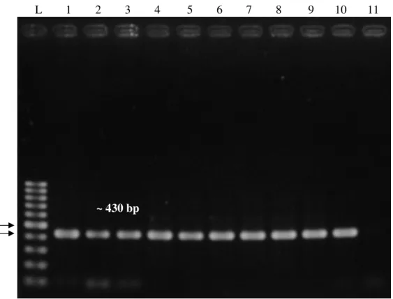Figure 4.1: Representative image of the 16S rRNA test of samples. 