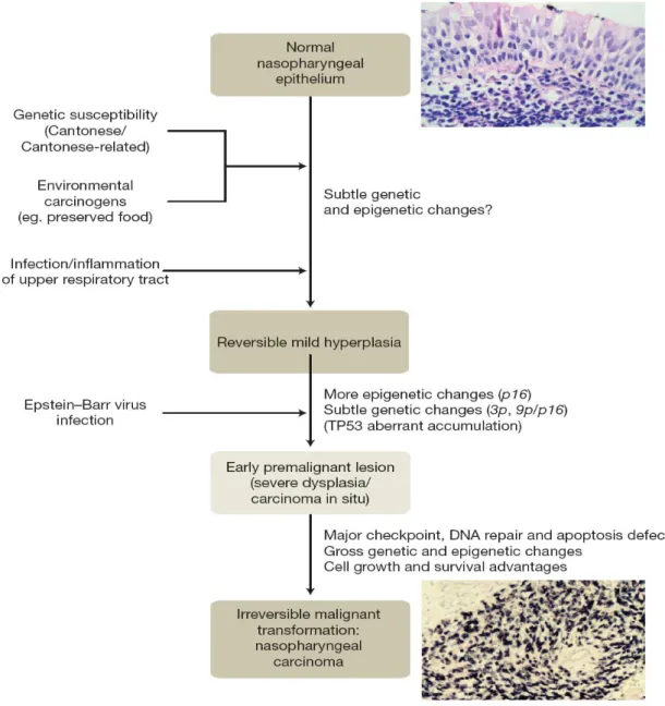 Figure 2: Possible model of nasopharyngeal carcinoma. The whole pathogenesis of NPC  might take approximately 40 years