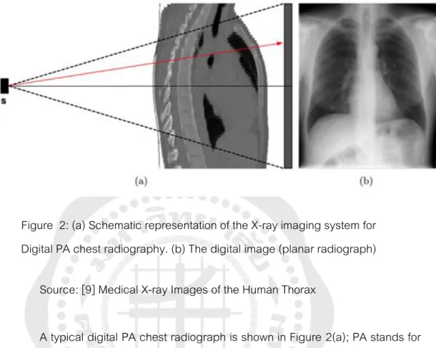Figure  2: (a) Schematic representation of the X-ray imaging system for   Digital PA chest radiography