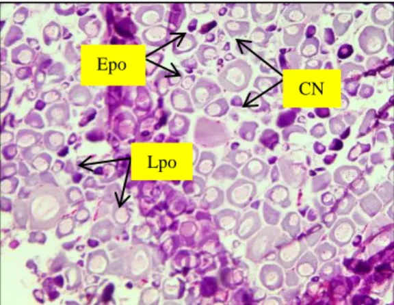 Fig.  24:  Primary  vitellogenic  stage  of  ovarian  development  of  T.  ilisha.  Here,  CN-  Chromatin  nucleolar,  Epo-  Early  perinucleolar  oocyte,  Lpo-  Late  perinucleolar oocyte 