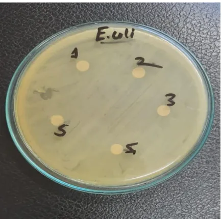Figure 4. 1: Petri dish with samples 1, 2, 3, 4, 5 with no inhibition zones  