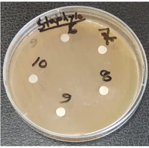 Figure 4. 4: Petri dish with samples 1, 2,  3, 4, 5 with no inhibition zone 