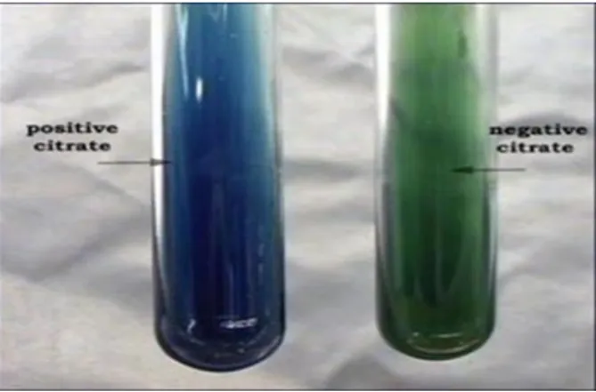 Figure 7 : Results of biochemical tests ; a) Citrate test; b) Indole production test; 