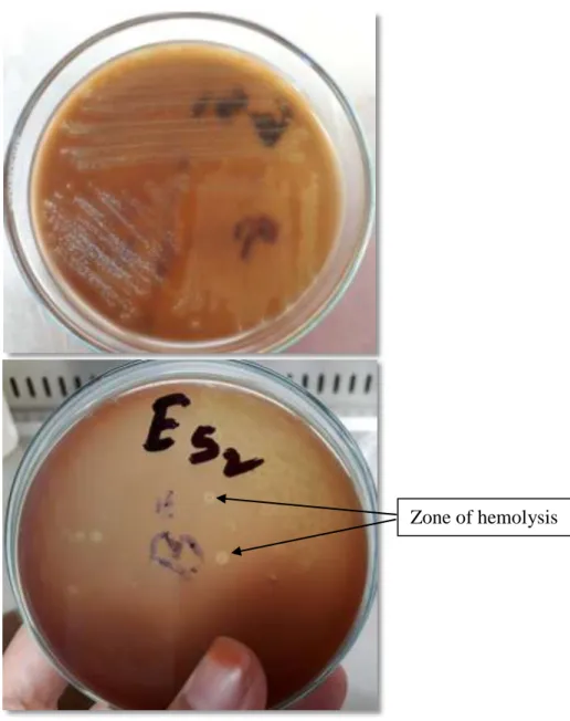 Figure 14. Growth of Streptococcus thermophilus on blood agar 