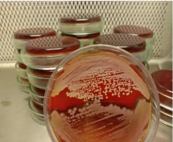 Fig.  7:  Staphylococcus  aureus  on  top  left  and  bottom  right,  Bacillus  subtilis  on  top  right and bottom left on Blood agar 