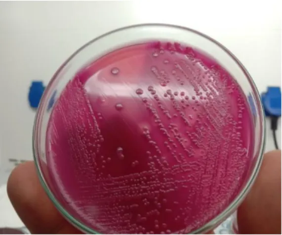 Fig. 10: E.coli in EMB agar                                 Fig 11: Culture Sensitivity Disc 