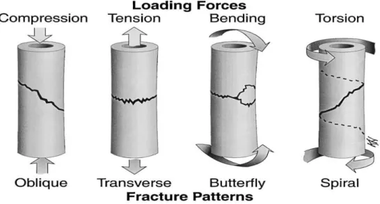 Figure 2: Types of loading forces applied to bone columns and resultant fractures  (Harari, 2002)