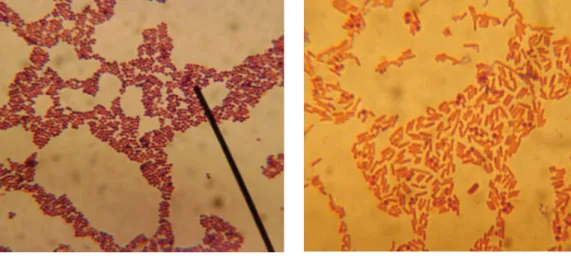 Fig. Bacteria under Microscope