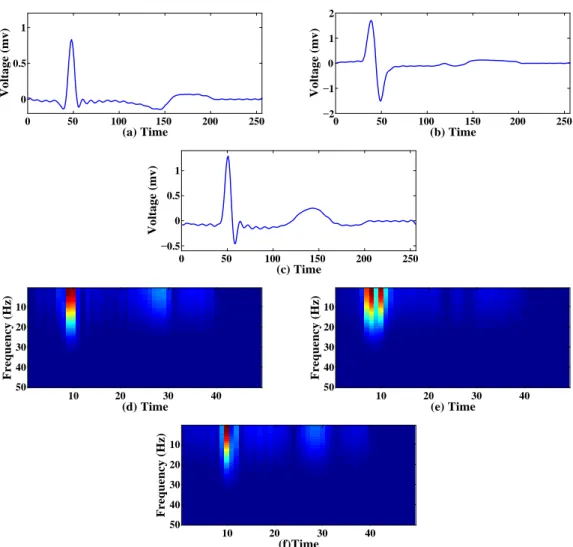 Fig.  4.3:  (a)(b)(c)  ECG  beats  for  three  different  persons,  (d)(e)(f)  Corresponding  spectrograms of (a) ,(b),(c) 