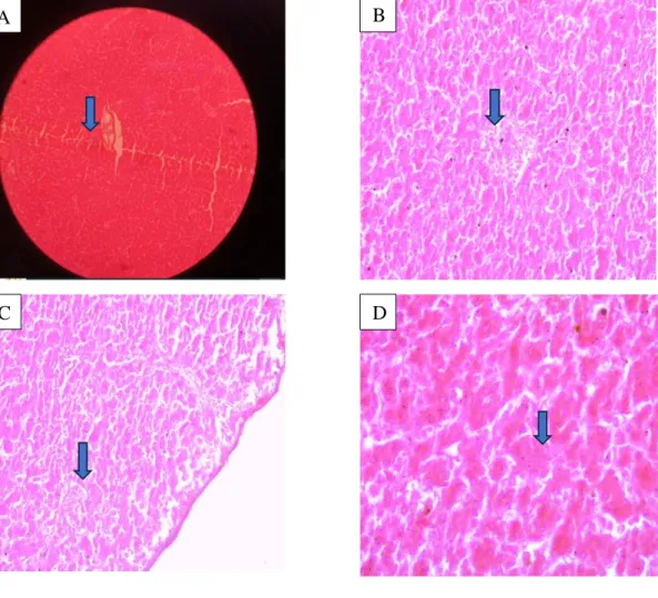 Figure 2.2: Diffuse necrosis in liver (A) and congestion and infiltration of lymphocyte  (B, C, D)