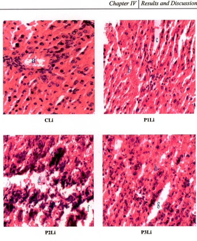 Figure 4.9: Histopathological section of liver of rabbits (Hematoxylin & Eosin x 200)  (CLi)  Control group liver; (P1 Li) 2 hours heated palm oil diet group liver; (P2Li) 10 hours heated  palm oil diet group liver; (P3Li) 20 hours heated palm oil diet
