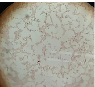 Figure 2.1: Gram negative cocci   Figure 2: Gram positive bacilli  