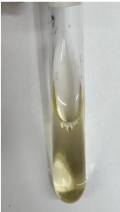 Figure 6: MR negative  Figure 6.1: MR positive  Figure 6.2: VP negative 