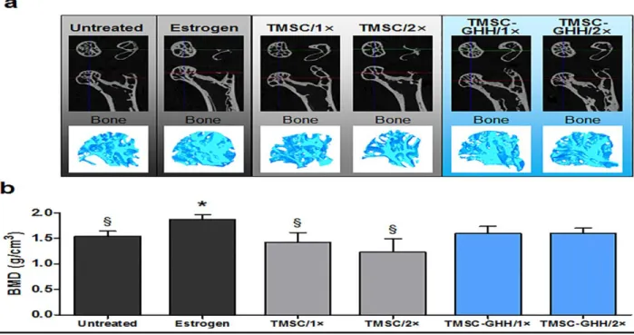 Figure 07: Micro CT images and bone mineral density of femoral head trabeculae at the experimental endpoint (Kim  et al., 2018)