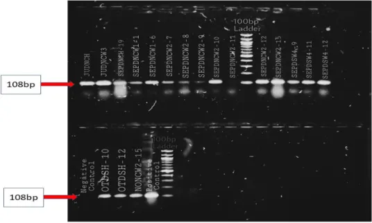Figure 5: Sa442 PCR for detecting the Staphylococcus aureus, 100 bp ladder was used 