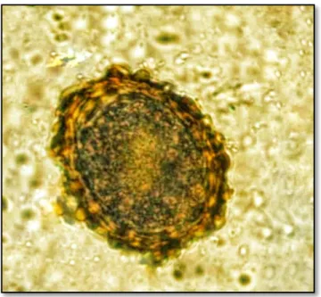 Fig. : Egg of Fasciolopsis sp 
