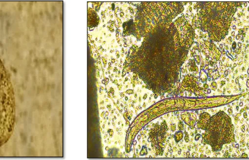 Fig. : Cyst of Balantidium coli 
