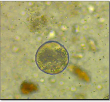 Fig. : Egg of Ascaris suum 