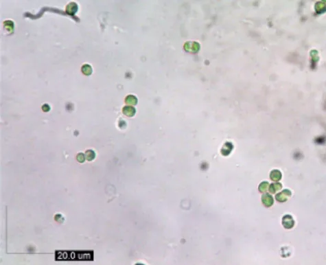 Figure 7. Larawan ng euryhaline microalgae na  Nanochlorum sp. 