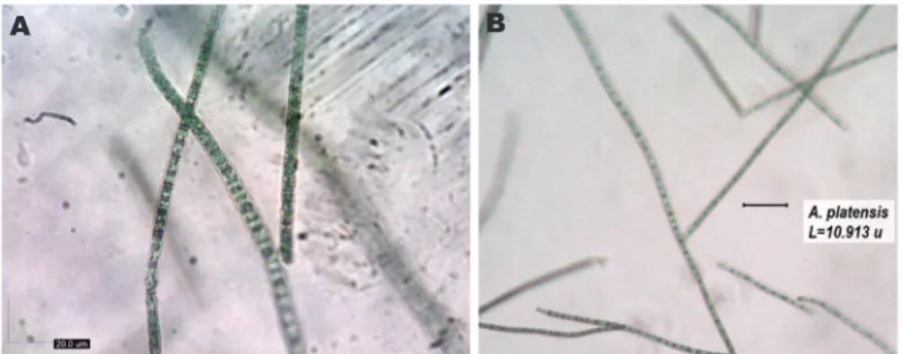 Figure 8. Arthrospira platensis sa ilalim ng microscope 