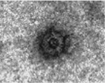 Figure  8:  Rotavirus-like  (DLP)  particles  consisting  of  VP2  and  VP6  from  transgenic  tomatoes