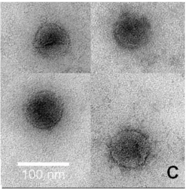 Figure 9: Transmission electron micrographs of VP2/VP6/VP7 produced in yeast cells  (Rodriguez-Limas, 2011)