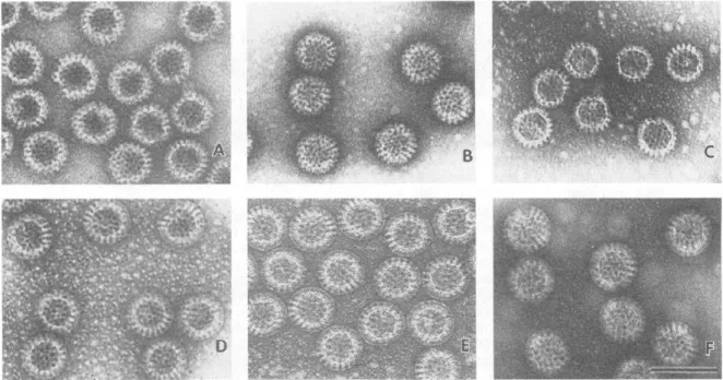 Figure 11: Electron micrographs of different formulations of SA11 VLPs produced  by coexpression of baculovirus recombinants