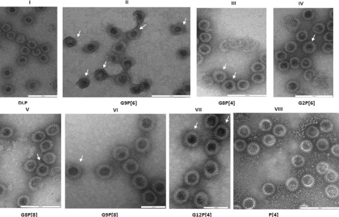 Figure 12: Electron micrographs of rotavirus-like particles produced in High Five® and  SF9 cells; (I) VP2/VP6 DLPs (II,  III,  IV, V, VI, VII, VIII) VP2/VP6/VP4/VP7 TLPs