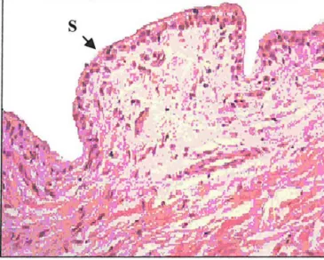 Figure 3.1  Photomicrograph of control synovial tissue 