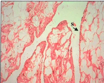 Figure 1.1  Normal synovium 