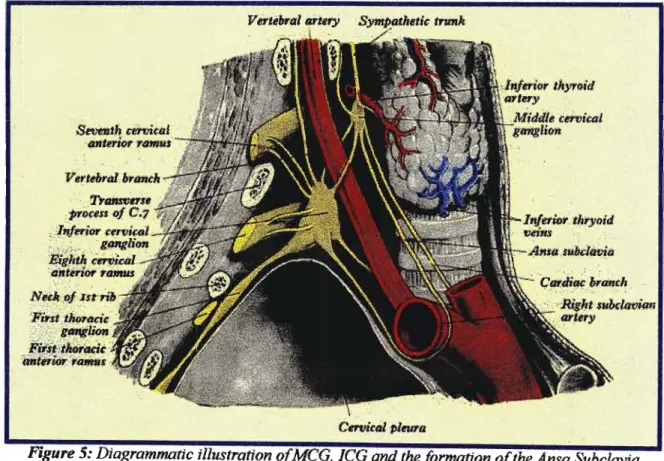 Figure 5: Diagrammatic illustration ofMCG, leG and the formation ofthe Ansa Subclavia (NOTE: The relationship ofMCG and the inferior thyroid artery)