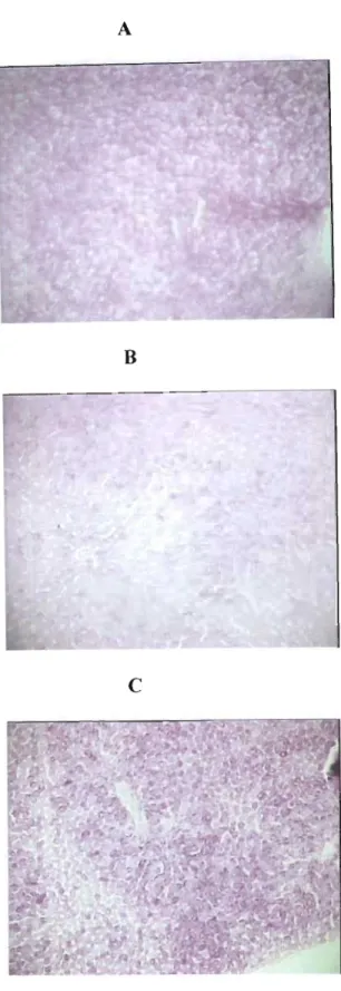 Figure 22.  Liver micrographs pas  stained showing magenta coloured glycogen stores  (A) vehicle treated normal rats, (B) vehicle treated diabetic (C) extract treated diabetic 