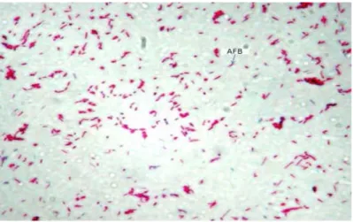 Figure 2.3 Microscopic v isualization  of s tained  Mycobacterium t uberculosis with Z iehl- iehl-Neelson staining procedure (Wiley , 2012 ).