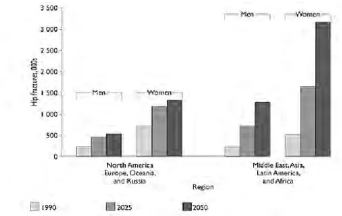 Figure 2.8: Estimated change in the global burden of hip fractures in men and  women from 1990 to 2050 in developed and developing countries