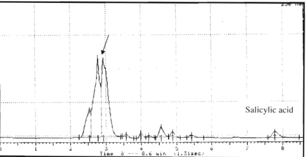 Figure 3.2: HPLC/uV chromatogram for spiked serum with salicylic acid and folinic acid at ratio of 70:30 (v/v) buffer: methanol, flow rate of lrnVrnin and wavelength of 250nm