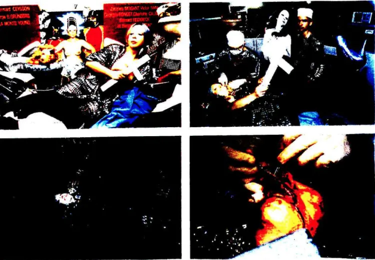 Fig. 16 Successful Operation (July 6, 1991). (Alain Dohme, Sipa Press) 