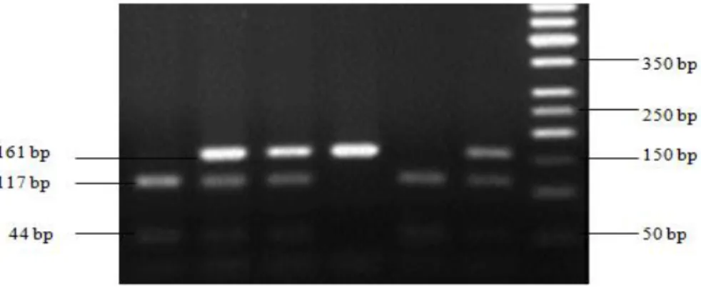 Figure 6.1: RFLP genotypes showing FUT1 M307 A/G polymorphisms. Lane 1 and 5: GG; Lane 2, 3 and  6: AG; Lane 4: undigested PCR product; Lane 7: 50 bp Ladder