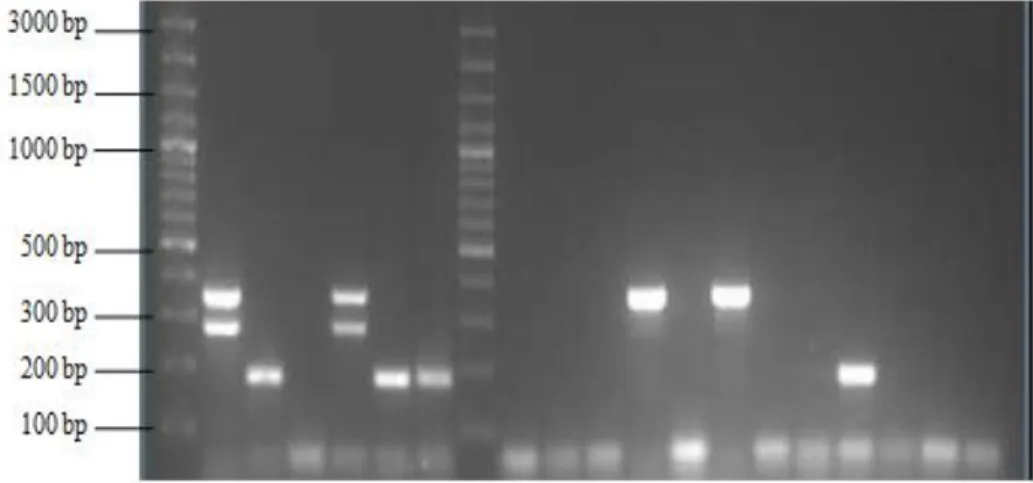 Figure 3.1: Typical gel picture showing ETEC virulence genes  STa, STb and LT. Lanes 1 and 8:100 bp  plus  DNA  ladder;  Lane  2:  K88/STb/LT  positive  reference  strain;  Lane  3:  K99  Pienk,  STa  positive  reference strain; Lane 4: E