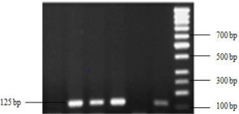 Figure  3.2:  Gel  picture  of  EAEC  isolates  showing  virulence  gene  EAST-1.  Lanes  1:  negative  isolate,  Lanes 2, 3, 4 and 6: EAST-1 positive isolate, Lane 5: no template control, Lane 7: 100 Plus DNA ladder