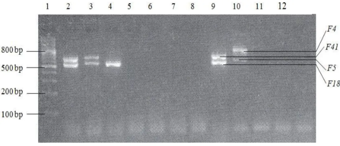 Figure 4. 1: Typical gel picture showing reference strains showing positive amplification of the fimbrial  genes,  F4,  F5,  F18  and  F41