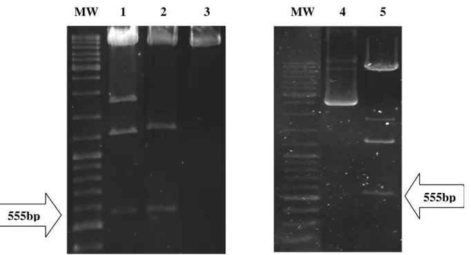 Figure  3.7:  Agarose  gel  image  of  restriction  digest  of  pFUNC1-GRC736S-eYFP,  pFUNC1- pFUNC1-GRA458T-eYFP, pFUNC1-eYFP, pFUNC1-GRΔAF1-eYFP and pFUNC1-GR-eYFP plasmids with  BglII  restriction  enzyme