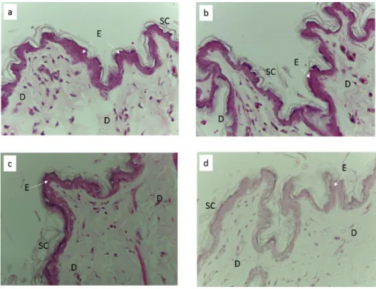 Fig 7. Photomicrographs of the control and the treated skin selections for light microscopy (LM) stained  with H&amp;E ; (× 40) a control/untreated, b treated with TNF gel, c treated with 2% w/w LLA TNF gel, d  treated with 2% w/w LLA1E 4 TNF gel