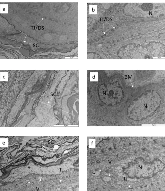 Fig.  8  Electron  micrographs  of  the  control  and  the  treated  skin  selections  for  transmission  electron  microscopy  (TEM)  :  a/b  control/untreated    (×  8000),  c  treated  with  2%  w/w  LLA  TNF  gel  (×  8000),  d  treated with 2% w/w LLA