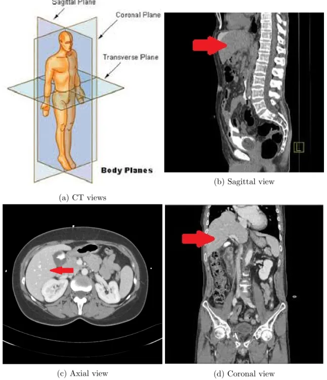 Figure 2.2: Liver in abdominal CT scan