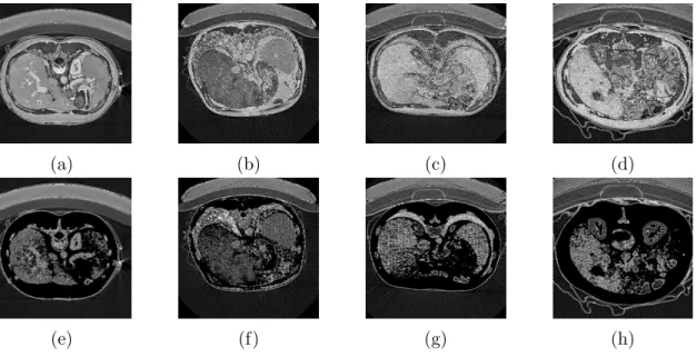Figure 3.3: Skeletonized Slices