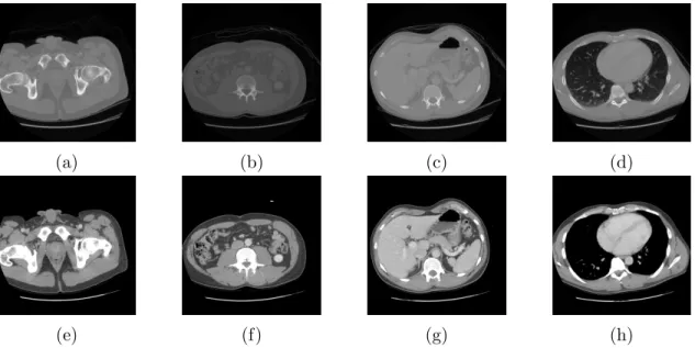 Figure 4.1: Slices before and after pre-processing