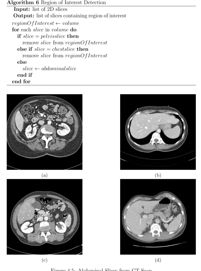 Figure 4.5: Abdominal Slices from CT Scan