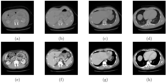Figure 5.2: Slices before and after pre-processing