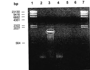 Figure 4-7. Partial amplification ofIBDV ORF Al by RT-PCR.